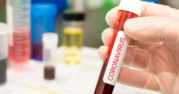 Coronavirus: Ministerio de Salud confirma octavo deceso y 2.449 casos positivos a nivel país